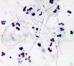 Фото грибок - возбудитель фарингомикоза под микроскопом