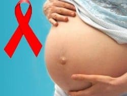 ВИЧ-инфекция и беременность