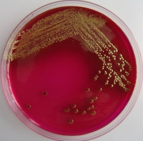 E.coli на питательной среде