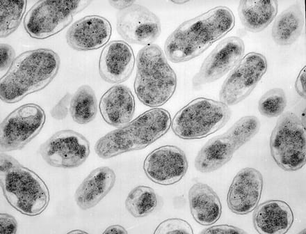 Бруцеллы под микроскопом