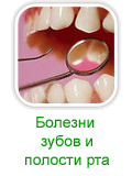 Симптомы и лечение болезней зубов и полости рта народными средствами