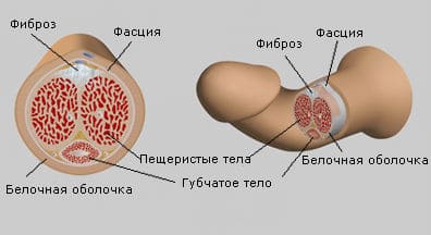 Анатомия болезни Пейрони