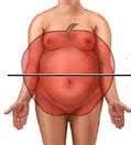 Абдоминальное ожирение 