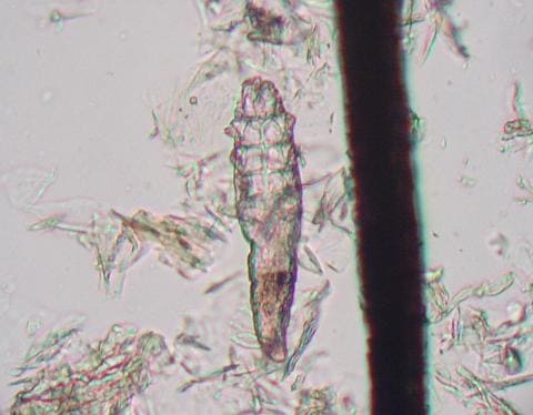 Демодекс на реснице под микроскопом