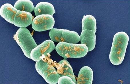 Listeria monocytogene - возбудитель листериоза у человека