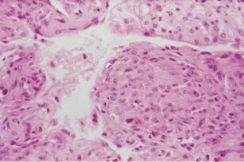 Веретенообразные клетки