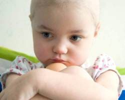 Неходжкинские злокачественные лимфомы у детей (лимфосаркомы)