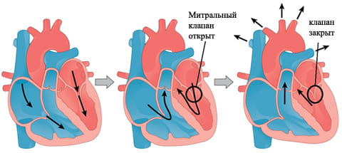 Пролапс митрального клапана сердца