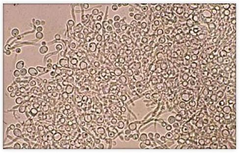 Грибы Candida,вызывающие молочницу при микроскопическом  исследовании