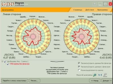 ГРВ диагностика (биоэлектрография) 