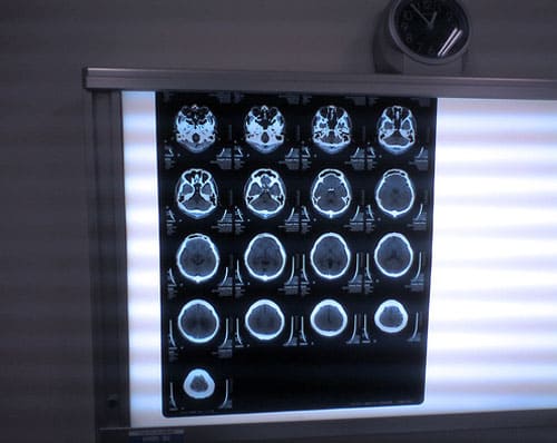 Магнитно-резонансная томография (МРТ). Показания, противопоказания МРТ. как проводится МРТ