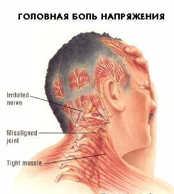 Головная боль (болит голова)